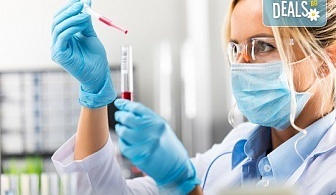 Изследване за антитела срещу СПИН (Аnti - HIV тест) в СМДЛ Кандиларов