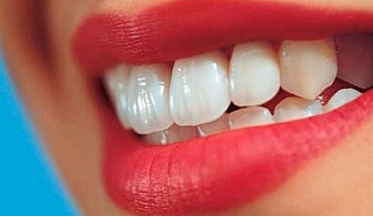 Лечение на зъбен кариес и поставяне на висококачествен материал фотополимерна пломба от 3M ESPE или Coltene Whaledent по избор с до 63% отстъпка от Дентална клиника CityDent!