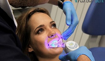 Опитайте СЕГА! Иновативна  система за ПРОФЕСИОНАЛНО ИЗБЕЛВАНЕ на зъби Whiteness XP Blue на цена от 99 лв. в стоматологична клиника Консумдент